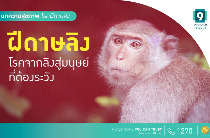  รู้จัก “โรคฝีดาษลิง” ที่กำลังระบาดพุ่งไม่หยุดในเมืองไทย
