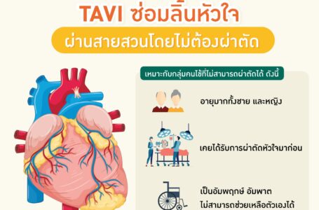 เทคนิค TAVI ซ่อมลิ้นหัวใจผ่านสายสวนโดยไม่ผ่าตัด