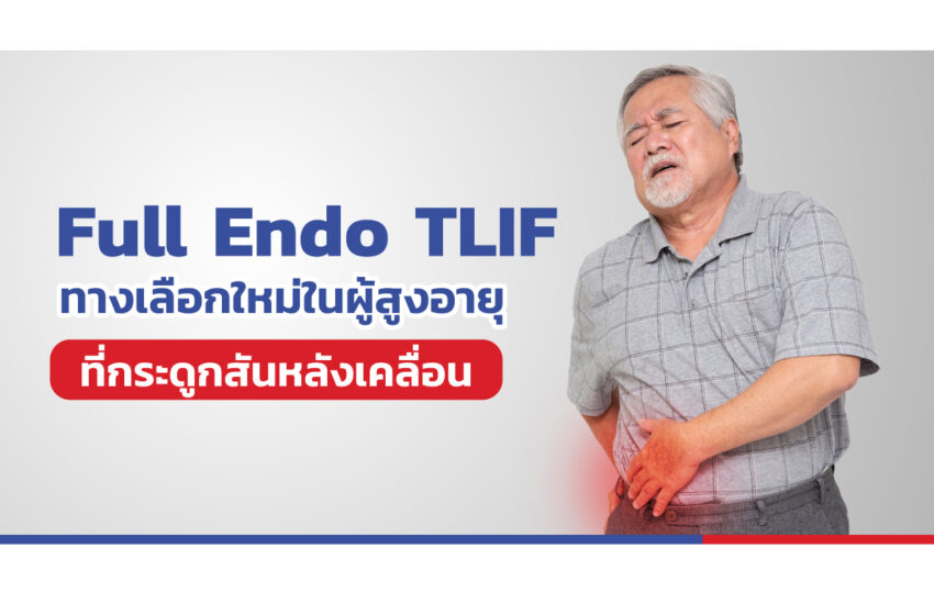 Full Endo TLIF ทางเลือกใหม่ในการผ่าตัดกระดูกสันหลังเคลื่อนใน “ผู้สูงอายุ”